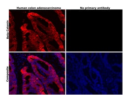 Invitrogen beta Catenin Recombinant Rabbit Monoclonal Antibody (SA30-04)