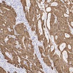 Invitrogen beta Catenin Recombinant Rabbit Monoclonal Antibody (SA30-04)