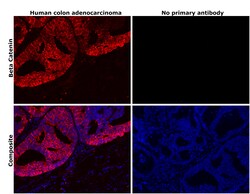 Invitrogen beta Catenin Recombinant Rabbit Monoclonal Antibody (SA30-04)