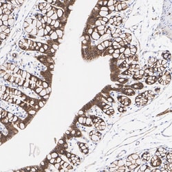 Invitrogen beta Catenin Recombinant Rabbit Monoclonal Antibody (SA30-04)