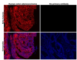 Invitrogen beta Catenin Recombinant Rabbit Monoclonal Antibody (SA30-04)