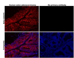 Invitrogen beta Catenin Recombinant Rabbit Monoclonal Antibody (SA30-04)