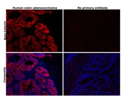 Invitrogen beta Catenin Recombinant Rabbit Monoclonal Antibody (SA30-04)