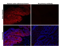 Invitrogen beta Catenin Recombinant Rabbit Monoclonal Antibody (SA30-04)