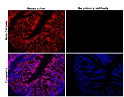 Invitrogen beta Catenin Recombinant Rabbit Monoclonal Antibody (SA30-04)