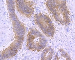 Invitrogen beta Catenin Recombinant Rabbit Monoclonal Antibody (SA30-04)