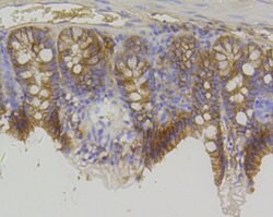 Invitrogen beta Catenin Recombinant Rabbit Monoclonal Antibody (SA30-04)