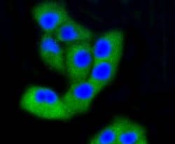 Invitrogen FAK Recombinant Rabbit Monoclonal Antibody (SR46-04) 100 &mu;L;
