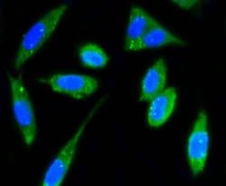Invitrogen FAK Recombinant Rabbit Monoclonal Antibody (SR46-04) 100 &mu;L;