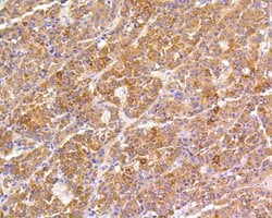 Invitrogen FAK Recombinant Rabbit Monoclonal Antibody (SR46-04) 100 &mu;L;