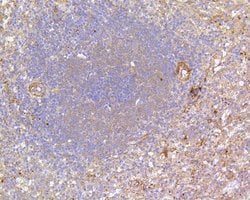 Invitrogen FAK Recombinant Rabbit Monoclonal Antibody (SR46-04) 100 &mu;L;