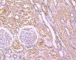 Invitrogen FAK Recombinant Rabbit Monoclonal Antibody (SR46-04) 100 &mu;L;
