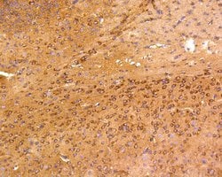 Invitrogen FAK Recombinant Rabbit Monoclonal Antibody (SR46-04) 100 &mu;L;