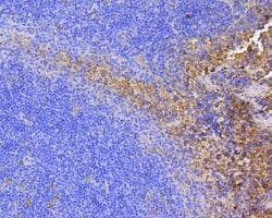 Invitrogen FAK Recombinant Rabbit Monoclonal Antibody (SR46-04) 100 &mu;L;
