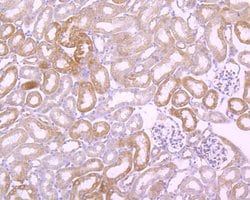 Invitrogen FAK Recombinant Rabbit Monoclonal Antibody (SR46-04) 100 &mu;L;