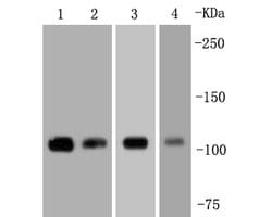 Invitrogen FAK Recombinant Rabbit Monoclonal Antibody (SR46-04) 100 &mu;L;