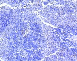 Invitrogen Survivin Recombinant Rabbit Monoclonal Antibody (SR44-02) 100