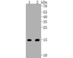 Invitrogen Survivin Recombinant Rabbit Monoclonal Antibody (SR44-02) 100