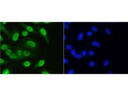 Invitrogen H3K36me1 Recombinant Rabbit Monoclonal Antibody (SR04-20) 100