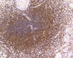 Invitrogen NFkB p50/p105 Recombinant Rabbit Monoclonal Antibody (SZ20-01)
