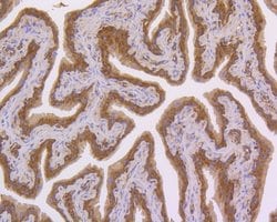 Invitrogen NFkB p50/p105 Recombinant Rabbit Monoclonal Antibody (SZ20-01)