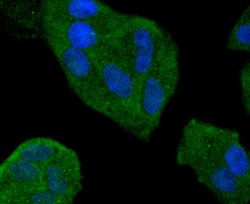 Invitrogen SMAD4 Recombinant Rabbit Monoclonal Antibody (SP05-05) 100 &mu;L;