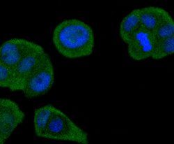 Invitrogen SMAD4 Recombinant Rabbit Monoclonal Antibody (SP05-05) 100 &mu;L;