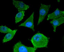 Invitrogen SMAD4 Recombinant Rabbit Monoclonal Antibody (SP05-05) 100 &mu;L;
