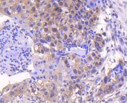 Invitrogen SMAD4 Recombinant Rabbit Monoclonal Antibody (SP05-05) 100 &mu;L;