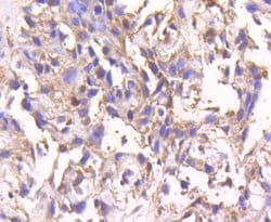 Invitrogen SMAD4 Recombinant Rabbit Monoclonal Antibody (SP05-05) 100 &mu;L;