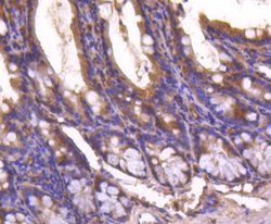 Invitrogen SMAD4 Recombinant Rabbit Monoclonal Antibody (SP05-05) 100 &mu;L;