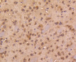 Invitrogen SMAD4 Recombinant Rabbit Monoclonal Antibody (SP05-05) 100 &mu;L;