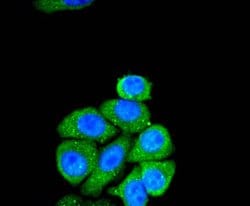 Invitrogen SMAD2 Recombinant Rabbit Monoclonal Antibody (SP06-05) 100 &mu;L;