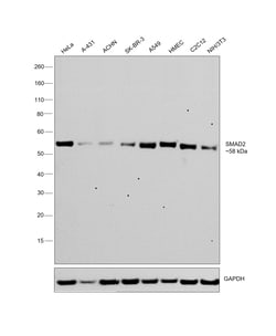 Invitrogen SMAD2 Recombinant Rabbit Monoclonal Antibody (SP06-05) 100 &mu;L;