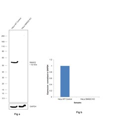 Invitrogen SMAD2 Recombinant Rabbit Monoclonal Antibody (SP06-05) 100 &mu;L;