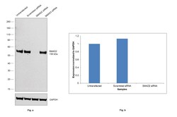 Invitrogen SMAD2 Recombinant Rabbit Monoclonal Antibody (SP06-05) 100 &mu;L;