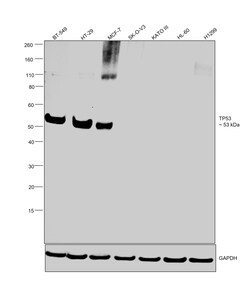 Invitrogen p53 Recombinant Rabbit Monoclonal Antibody (SY010-6) 100 &mu;L;
