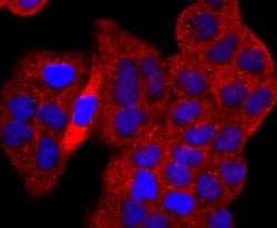 Invitrogen p53 Recombinant Rabbit Monoclonal Antibody (SY010-6) 100 &mu;L;