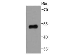 Invitrogen p53 Recombinant Rabbit Monoclonal Antibody (SY010-6) 100 &mu;L;