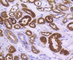 Invitrogen ALDH1A1 Recombinant Rabbit Monoclonal Antibody (SY11-02) 100