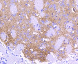 Invitrogen ALDH1A1 Recombinant Rabbit Monoclonal Antibody (SY11-02) 100
