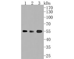 Invitrogen ALDH1A1 Recombinant Rabbit Monoclonal Antibody (SY11-02) 100