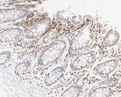 Invitrogen STAT1 Recombinant Rabbit Monoclonal Antibody (SJ01-89) 100 &mu;L;