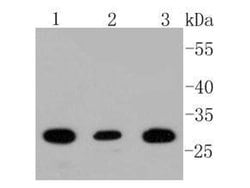 Invitrogen BDNF Recombinant Rabbit Monoclonal Antibody (SJ12-09) 100 &mu;L;