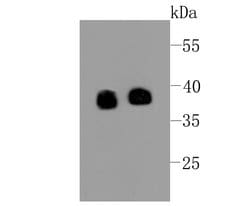 Invitrogen Synaptophysin Recombinant Rabbit Monoclonal Antibody (SJ26-85) 100 &mu;L | Buy Online | Invitrogen&trade; | Fisher Scientific