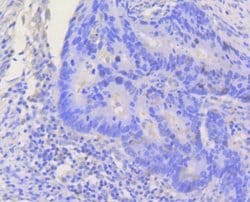 Invitrogen STAT3 Recombinant Rabbit Monoclonal Antibody (SY34-01) 100 &mu;L;