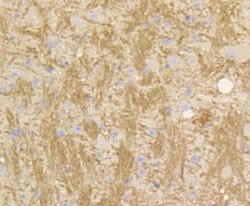 Invitrogen STAT3 Recombinant Rabbit Monoclonal Antibody (SY34-01) 100 &mu;L;