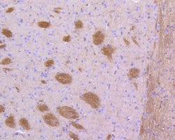 Invitrogen STAT3 Recombinant Rabbit Monoclonal Antibody (SY34-01) 100 &mu;L;