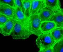 Invitrogen Alpha-Smooth Muscle Actin Recombinant Rabbit Monoclonal Antibody (SY02-64) 100 &mu;L | Buy Online | Invitrogen&trade; | Fisher Scientific