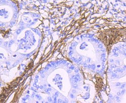 Invitrogen Alpha-Smooth Muscle Actin Recombinant Rabbit Monoclonal Antibody (SY02-64) 100 &mu;L | Buy Online | Invitrogen&trade; | Fisher Scientific